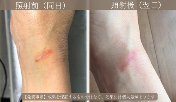 ルビッシュ体験された比較症例2